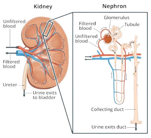 nephrotic syndrome removebg preview