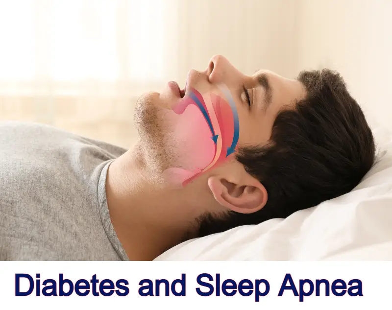 diabetes and sleep apnea