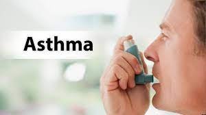 Allergic Asthma (Extrinsic Asthma)