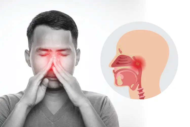 nasopharyngeal cancer (npc)