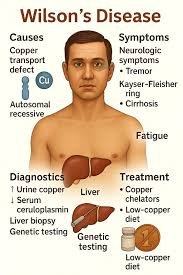 wilson’s disease – copper overload in the body