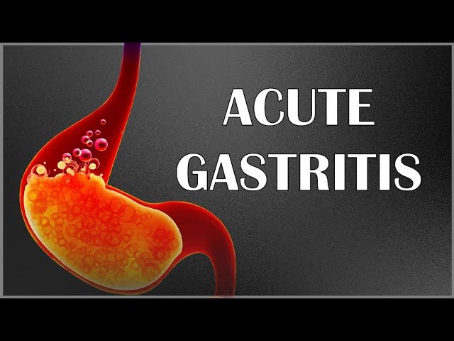 Acute Gastritis