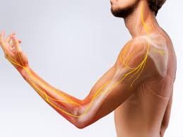 Cervical Radiculopathy