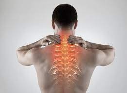 Cervical Spondylotic Radiculopathy